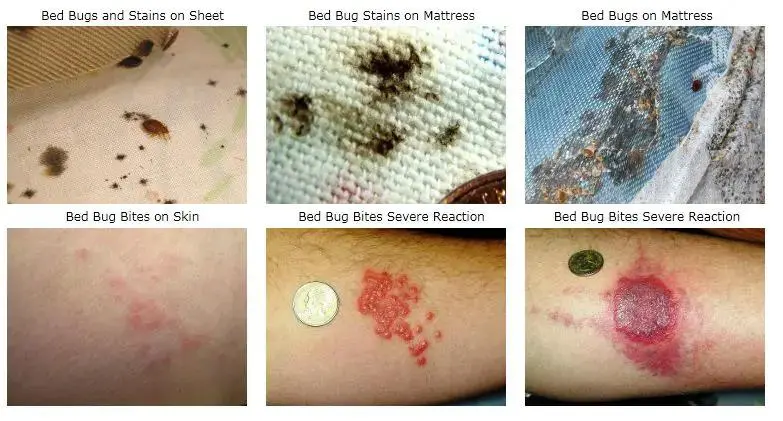bed bug sevice